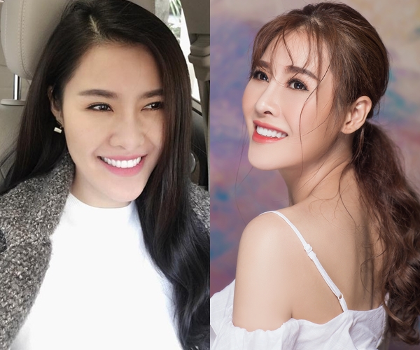 6 sao Việt công khai thừa nhận phẫu thuật thẩm mỹ trong năm 2017